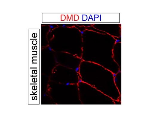 [12715-1-AP-150UL] Dystrophin Polyclonal antibody