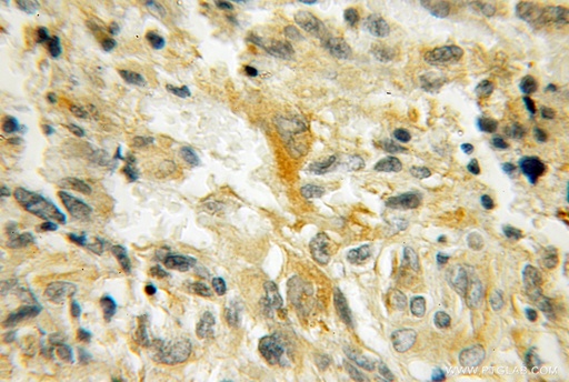 [12717-1-AP-150UL] PMP2 Polyclonal antibody