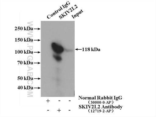 [12719-2-AP-150UL] SKIV2L2 Polyclonal antibody