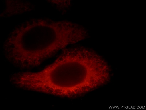 [12723-1-AP-20UL] EXOC6 Polyclonal antibody