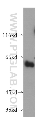 [12726-1-AP-20UL] Synaptotagmin-3 Polyclonal antibody