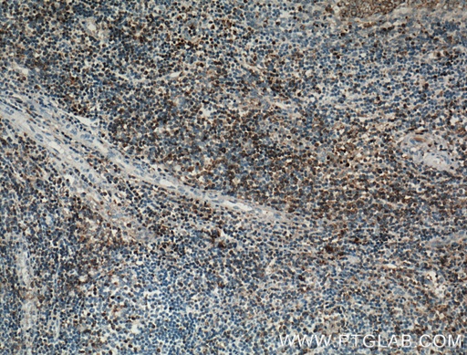 [12728-1-AP-20UL] SLP76 Polyclonal antibody