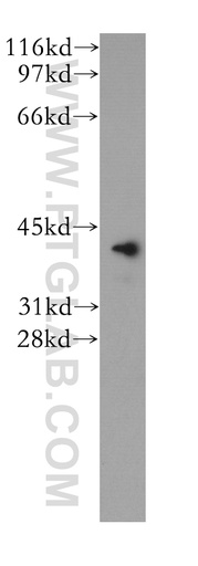 [12730-1-AP-150UL] VASH1 Polyclonal antibody