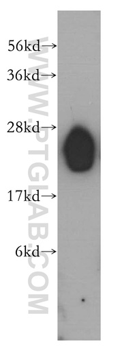 [12732-1-AP-150UL] LIN7B Polyclonal antibody