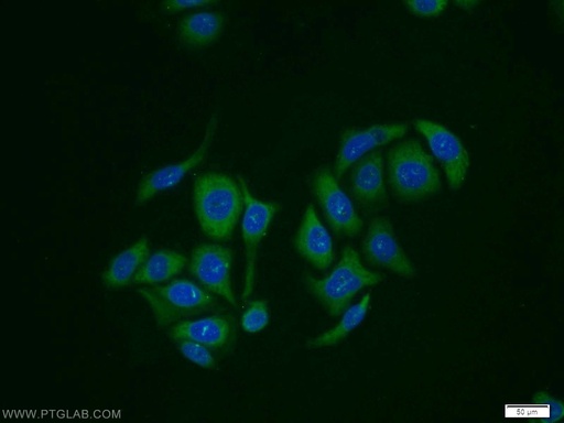 [12735-1-AP-150UL] RabGEF1 Polyclonal antibody
