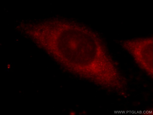 [12737-1-AP-20UL] ZFP36 Polyclonal antibody