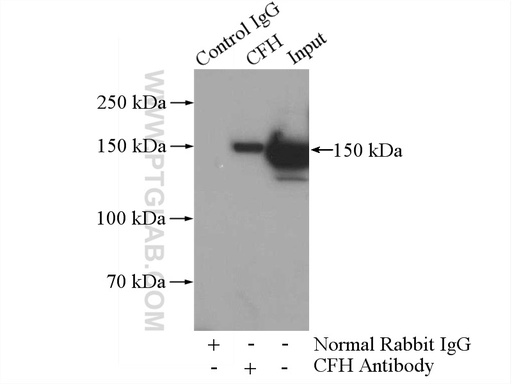 [12748-1-AP-150UL] Complement factor H Polyclonal antibody