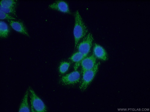 [12751-1-AP-150UL] SEC5/EXOC2 Polyclonal antibody