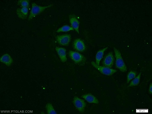 [12752-1-AP-20UL] DPP8 Polyclonal antibody