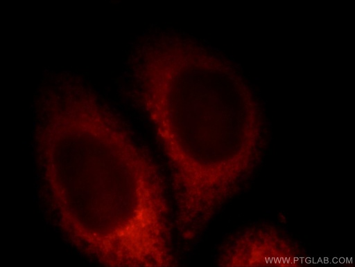 [12753-1-AP-150UL] PDE12 Polyclonal antibody