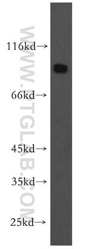 [12756-1-AP-150UL] DNAI1 Polyclonal antibody