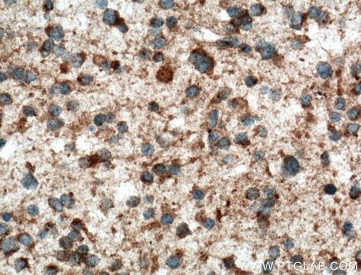 [12760-1-AP-150UL] KIF1C Polyclonal antibody