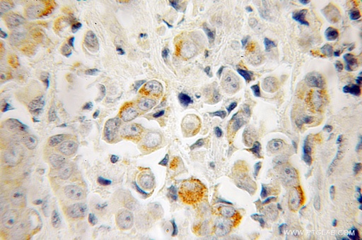 [12762-1-AP-150UL] RTKN Polyclonal antibody