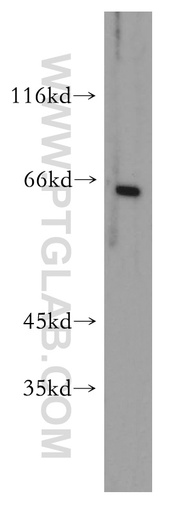 [12764-1-AP-20UL] FOXG1 Polyclonal antibody