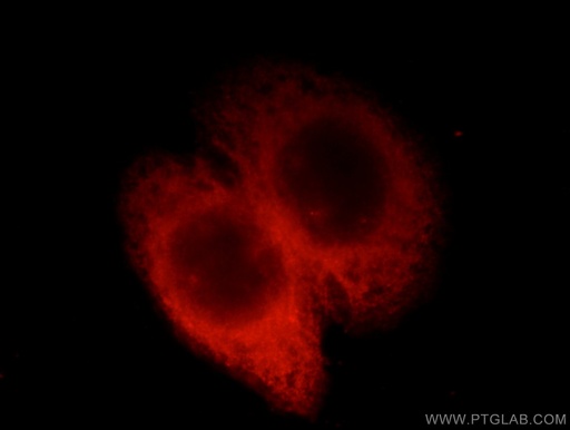 [12765-1-AP-150UL] EML1 Polyclonal antibody