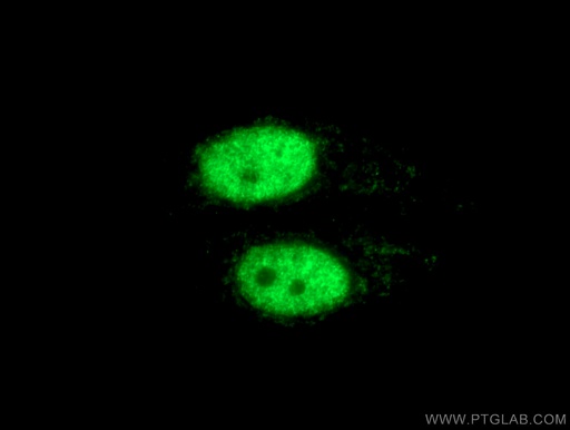 [12770-1-AP-150UL] HNRNPD Polyclonal antibody