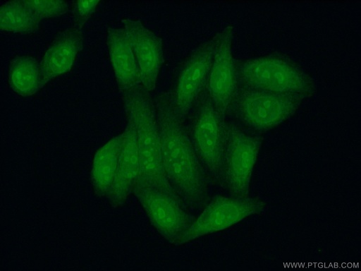 [12772-1-AP-150UL] KRR1 Polyclonal antibody