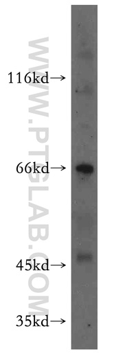 [12775-1-AP-20UL] MEIS3 Polyclonal antibody