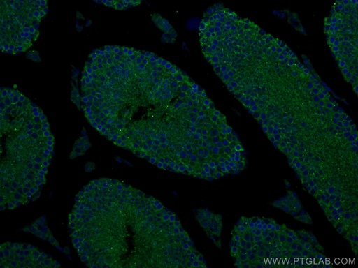 [12776-1-AP-20UL] SLC26A8 Polyclonal antibody