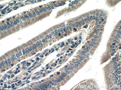 [12781-1-AP-20UL] CBLB Polyclonal antibody