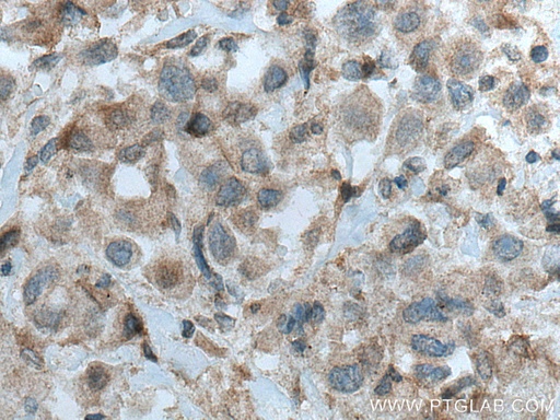 [12785-1-AP-150UL] PRKD3 Polyclonal antibody