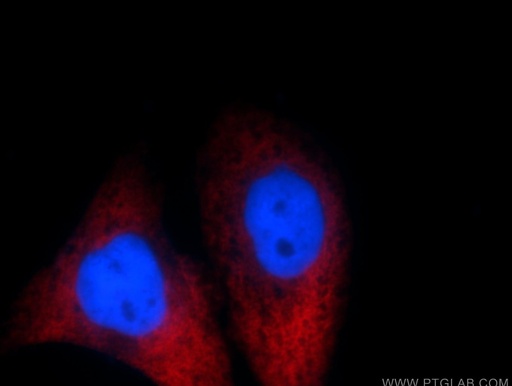 [12786-2-AP-150UL] MAGEB4 Polyclonal antibody