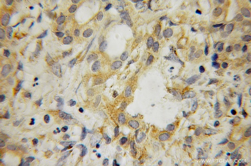 [12792-1-AP-150UL] SRFBP1 Polyclonal antibody