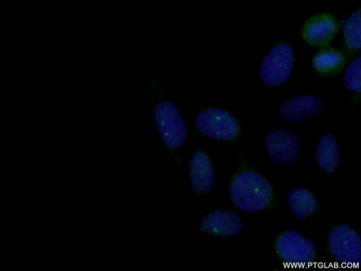 [12794-1-AP-20UL] Centrin 1 Polyclonal antibody