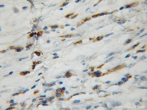 [12795-1-AP-20UL] GAGE1 Polyclonal antibody