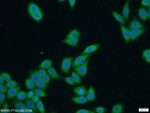 [12798-1-AP-150UL] SECISBP2 Polyclonal antibody