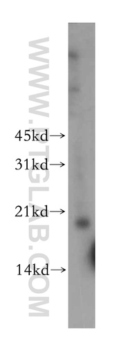 [12800-1-AP-20UL] TPRKB Polyclonal antibody