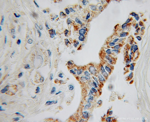 [12801-1-AP-20UL] GATM Polyclonal antibody