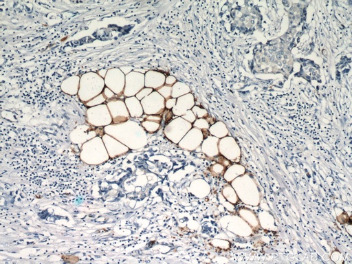 [12802-1-AP-150UL] FABP4 Polyclonal antibody