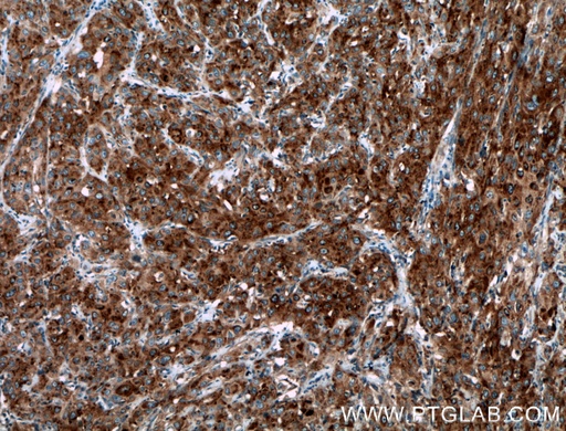 [12805-1-AP-20UL] SEPT6 Polyclonal antibody