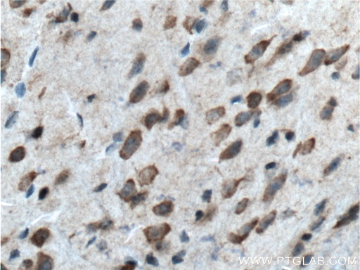 [12807-1-AP-150UL] BACE1 Polyclonal antibody