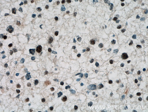 [12810-1-AP-20UL] ARNT2 Polyclonal antibody
