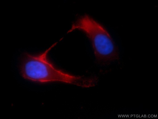 [12813-1-AP-20UL] TRPM8 Polyclonal antibody