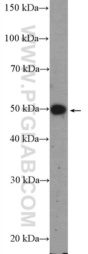 [12815-1-AP-150UL] LRAT Polyclonal antibody