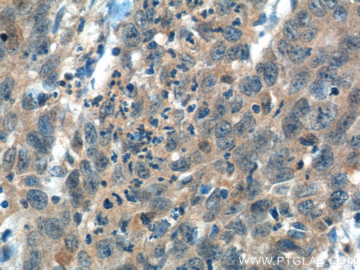 [12816-1-AP-20UL] ITPKB Polyclonal antibody