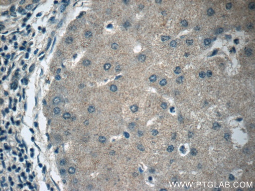 [12817-1-AP-20UL] APOM Polyclonal antibody
