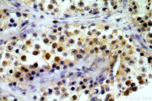 [12818-1-AP-20UL] TAF1B Polyclonal antibody