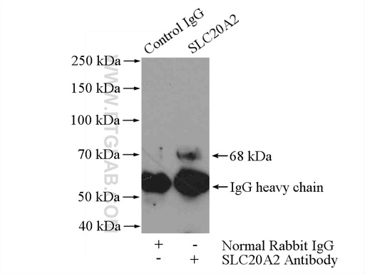 [12820-1-AP-20UL] SLC20A2 Polyclonal antibody