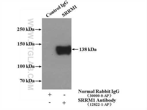 [12822-1-AP-150UL] SRRM1 Polyclonal antibody