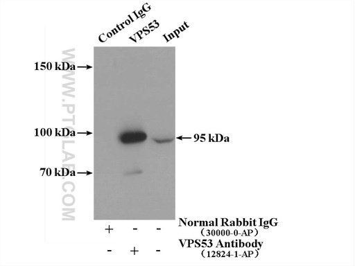 [12824-1-AP-150UL] VPS53 Polyclonal antibody