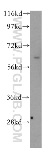 [12825-1-AP-20UL] AF9 Polyclonal antibody