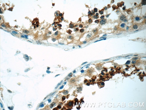 [12829-1-AP-150UL] SPACA1 Polyclonal antibody