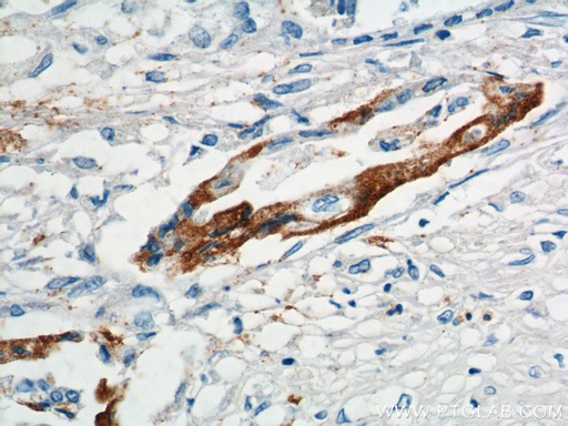 [12830-1-AP-20UL] XK Polyclonal antibody