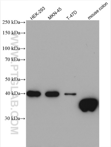 [12832-1-AP-150UL] GIPC2 Polyclonal antibody