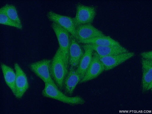 [12834-1-AP-20UL] HDAC6 Polyclonal antibody