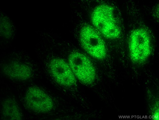 [12835-1-AP-150UL] KDM3A,JMJD1A Polyclonal antibody